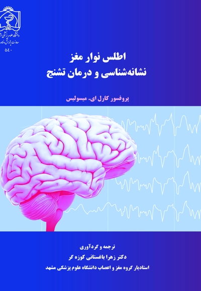 اطلس نوار مغز، نشانه شناسی و درمان تشنج